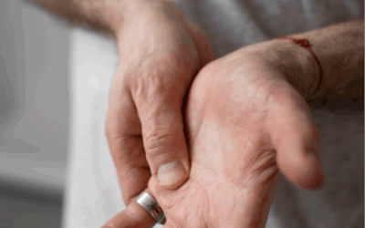 Ulnar Tünel Sendromu