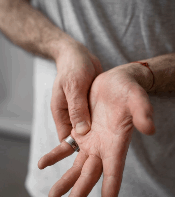 Ulnar Tünel Sendromu